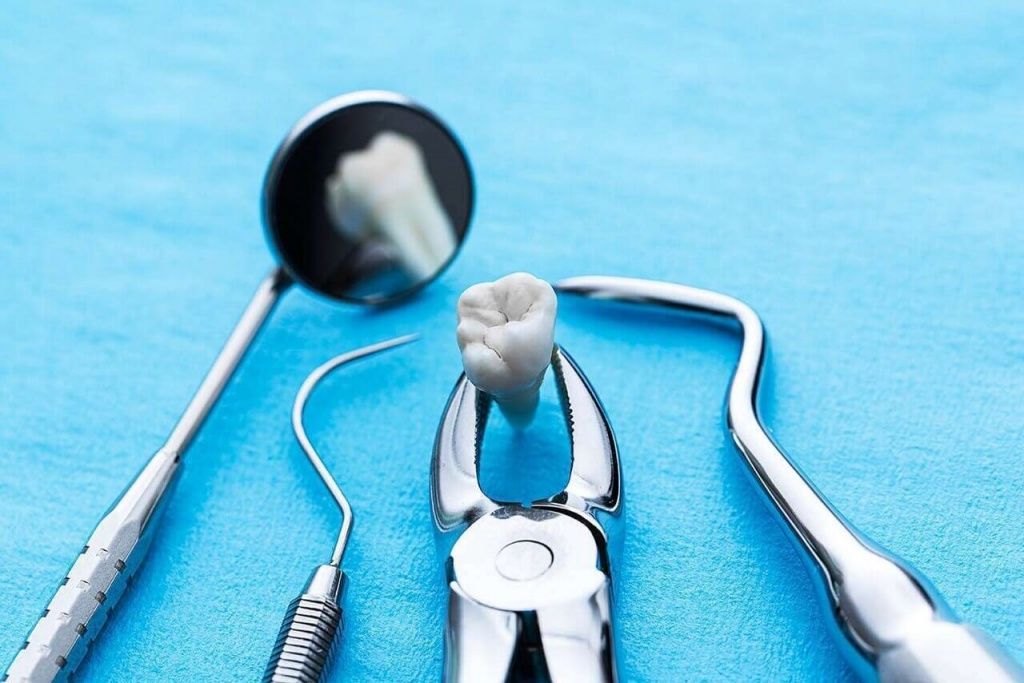 Хирургическая стоматология - изображение
