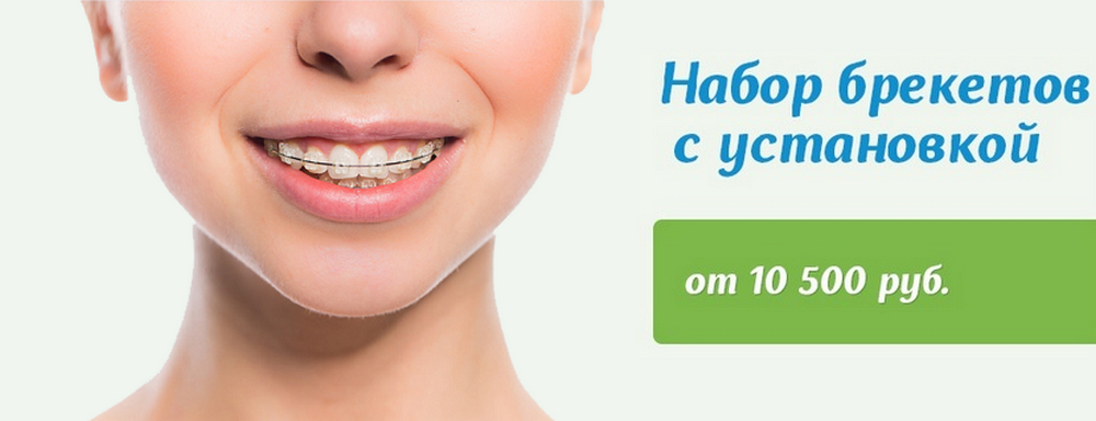 banner-breket.png banner-breket.png