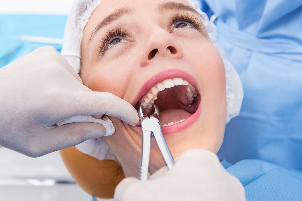 Удаление зуба - изображение