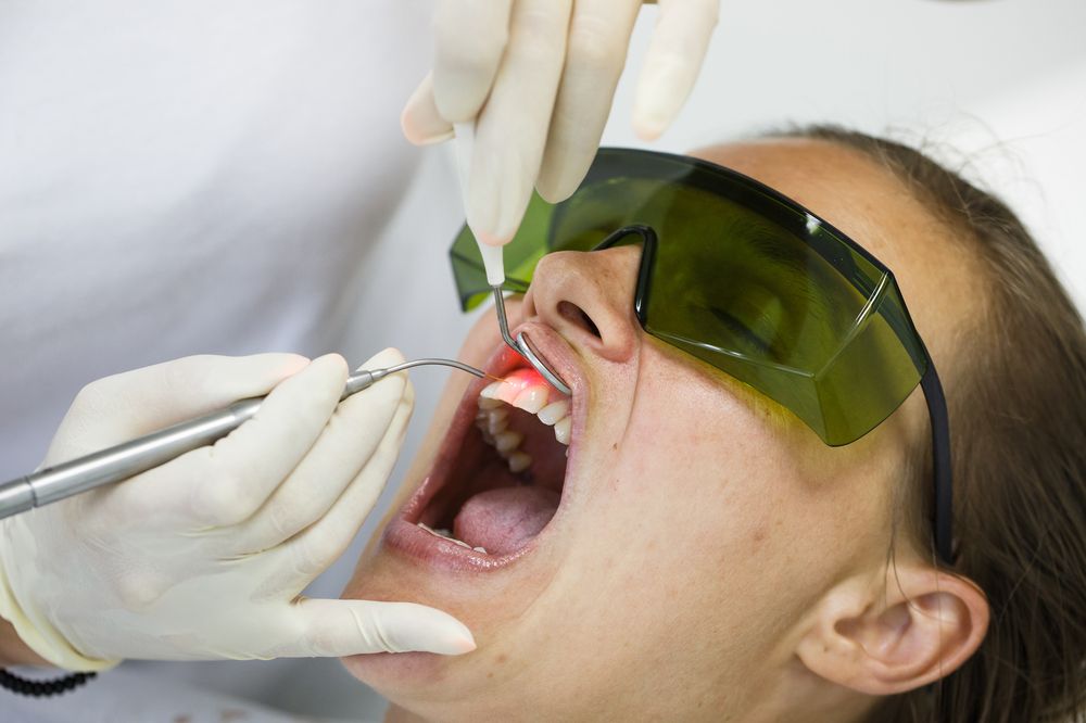 Лазеротерапия в стоматологии - изображение